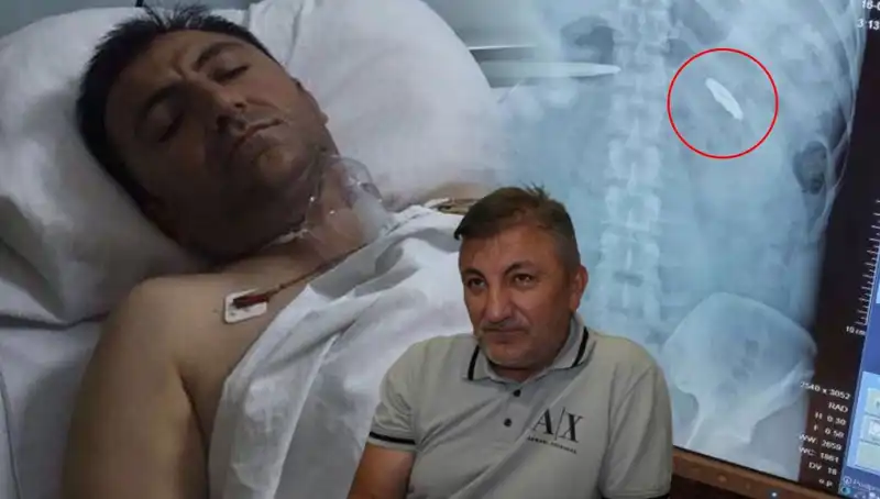 15 Temmuz'dan Sonra Değişen Hayatlar: Vücudundaki Kurşunla 9 Yıl