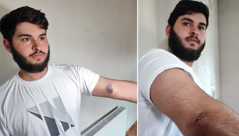 Bahçeye Düşen Top Krizi: Conolar Kamyonetle Geldi!